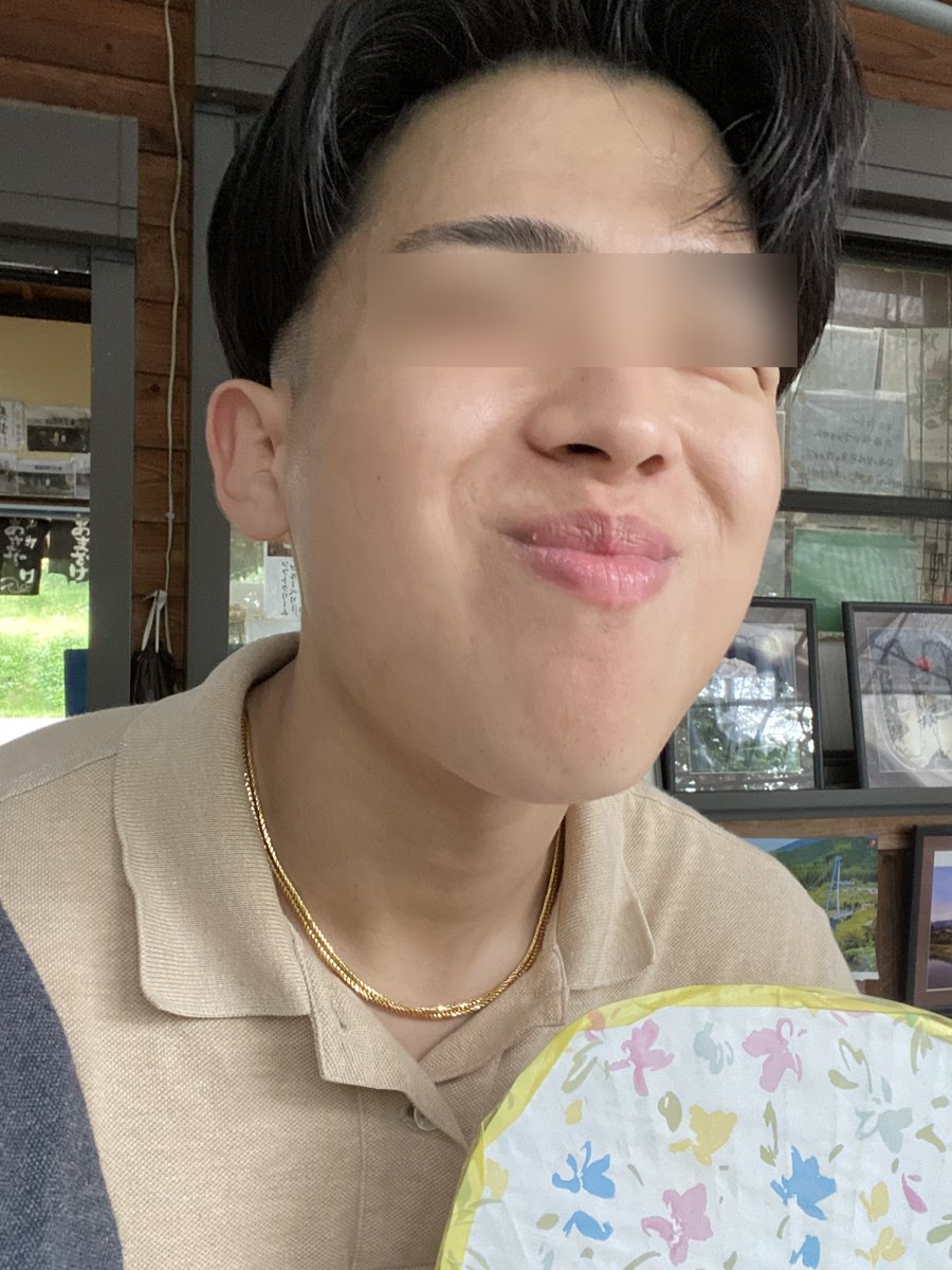 現在の肌の写真（目元は加工済み）